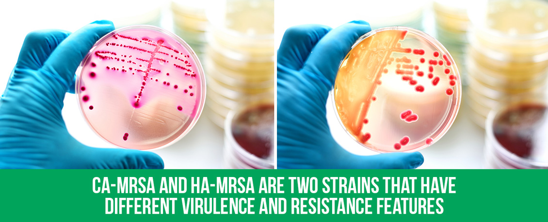 Two Gloved Hands Holding Each a Petri Dish With Different Types of Staph Bacteria