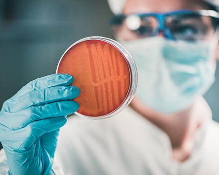 Scientist With Mask and Gloves Holding a Petri Dish With Staph Bacteria