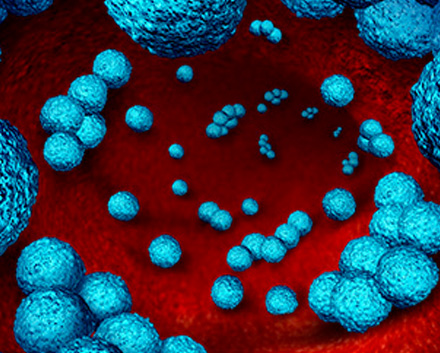 MRSA Can Infect The Blood Stream