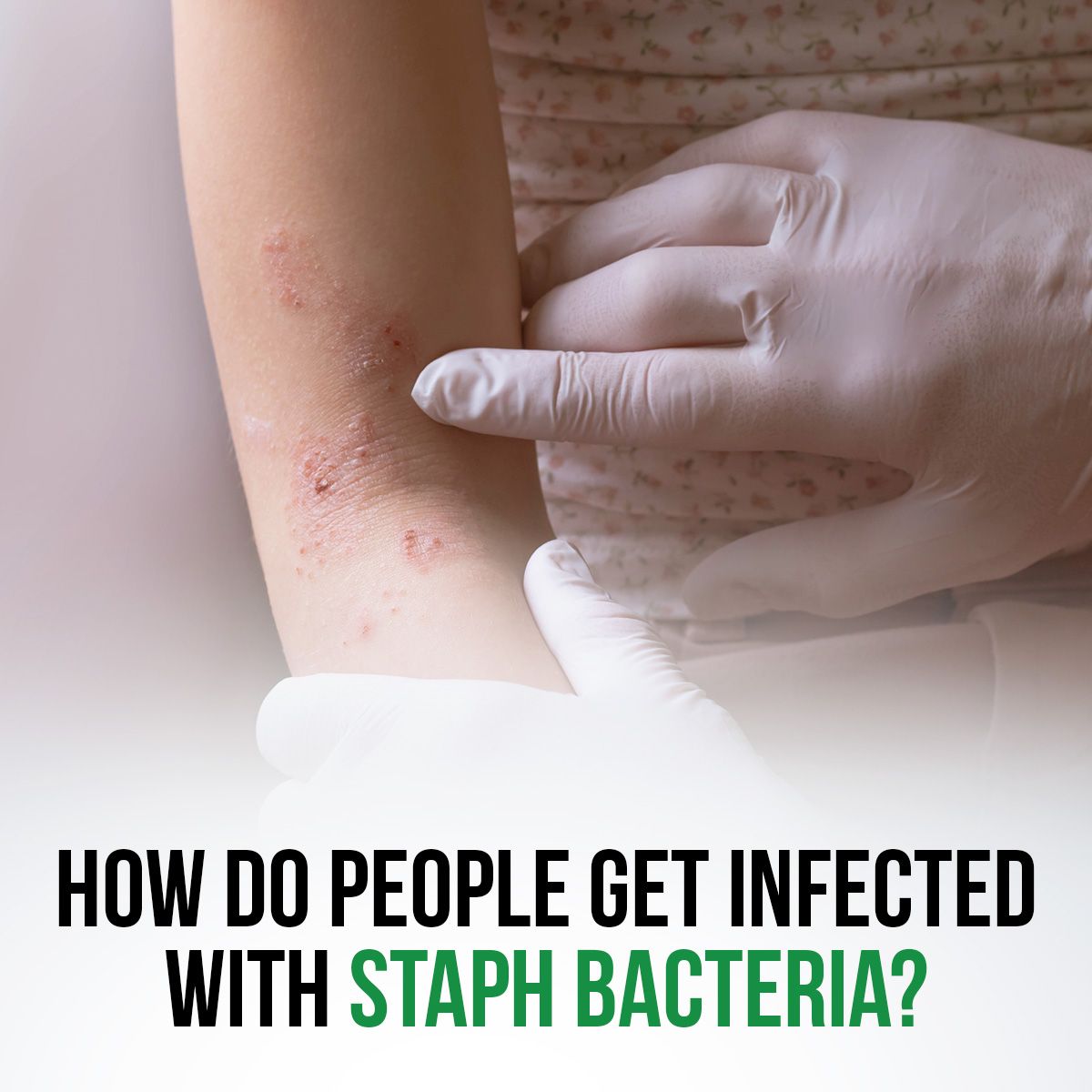 How Do People Get Infected With Staph Bacteria?