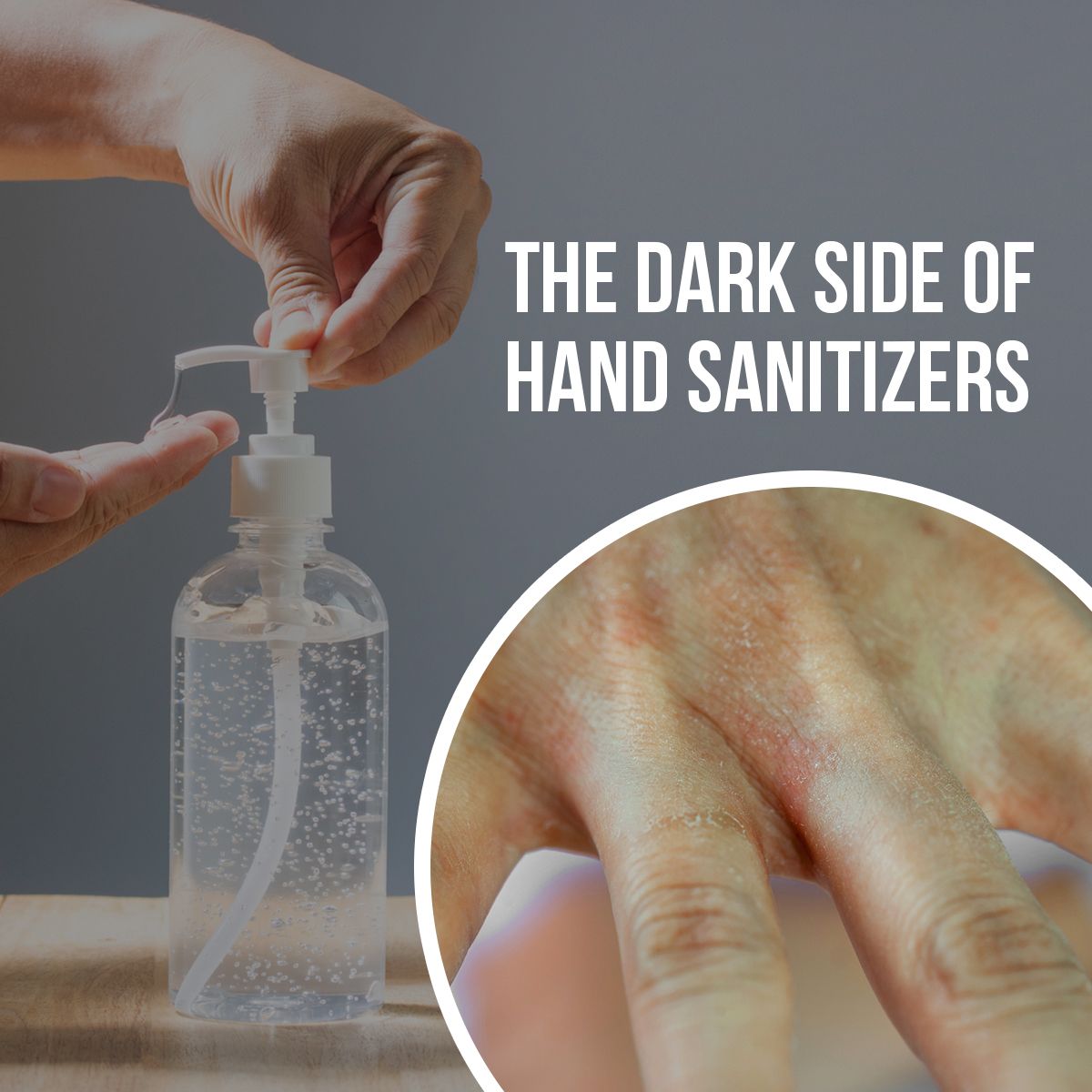 The Dark Side of Hand Sanitizers